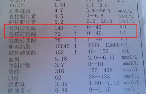 谷丙转氨酶.jpg